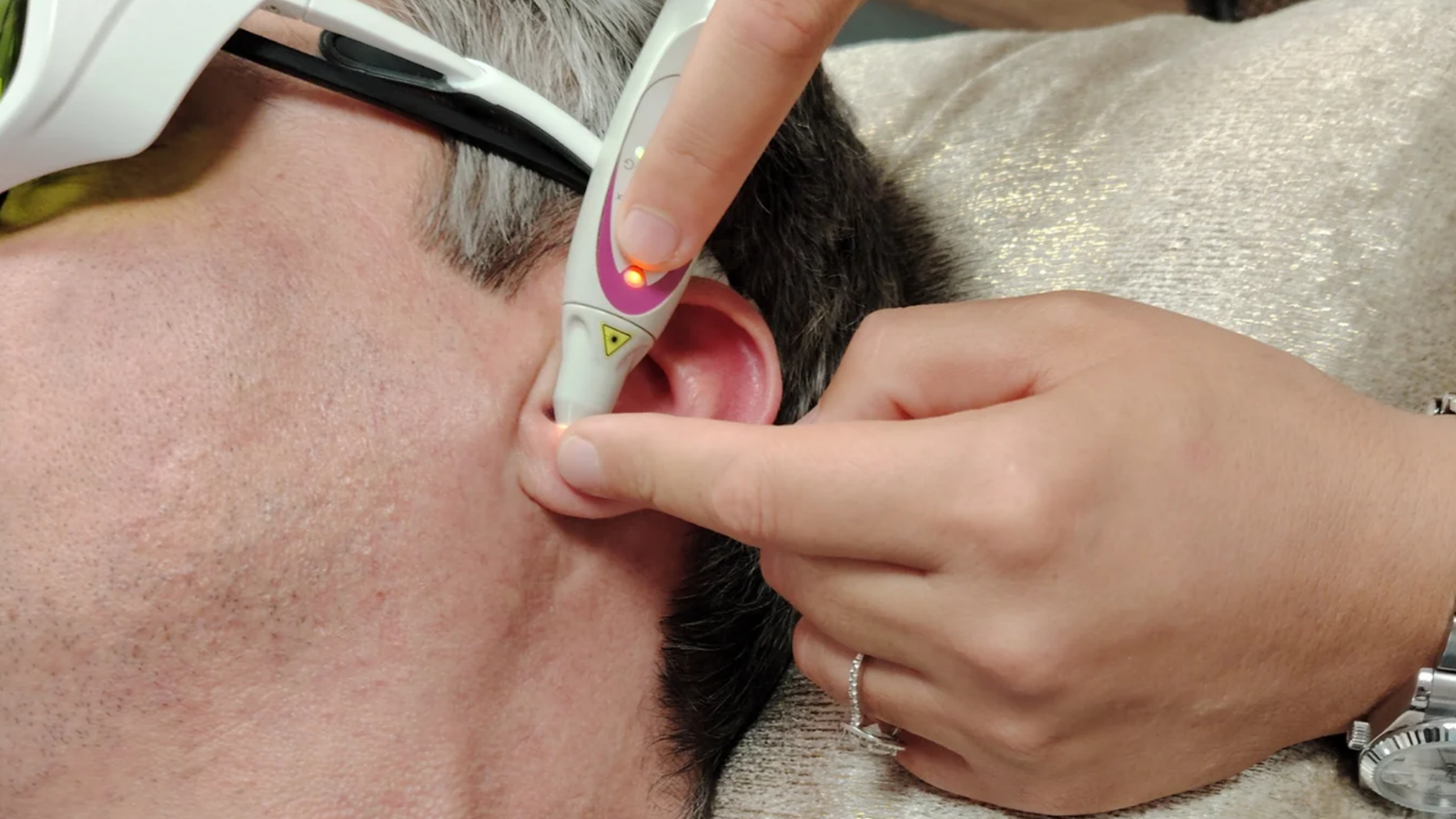 Laser oreille Biganos : la stimulation auriculaire sans aiguille