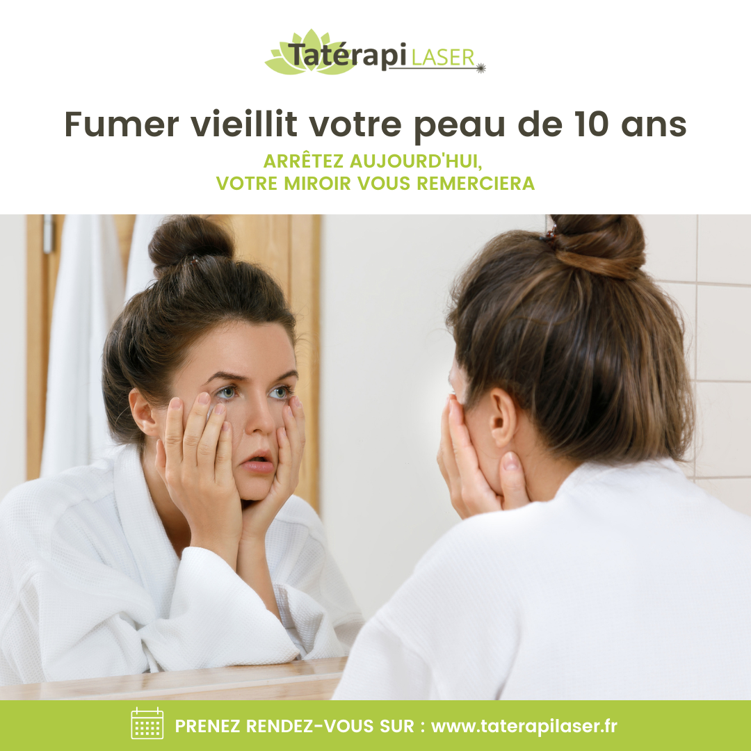 Tatérapi Laser Laval