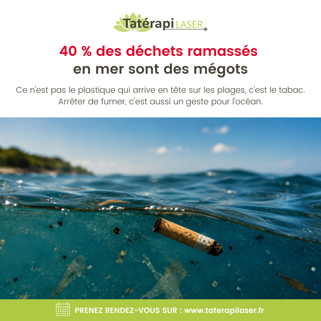 Tatérapi Laser La Ferté-Saint-Aubin