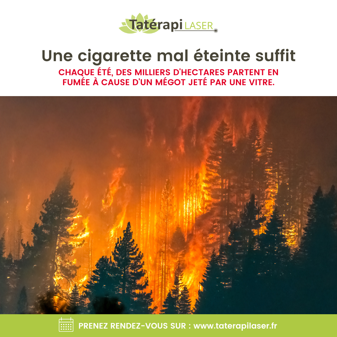 Tatérapi Laser Laval