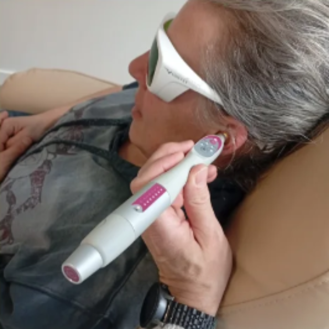 Centre Tabac Laser - Centre Tatérapi Laser de Bourg-en-Bresse