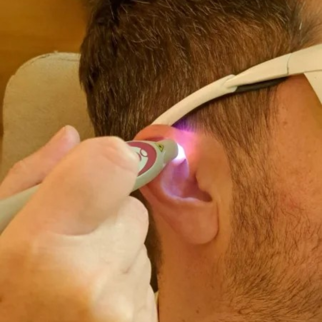 Centre Tabac Laser - Centre Tatérapi Laser de Genève
